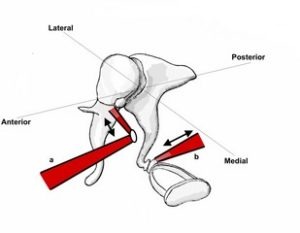 Radiopaedia - Drawing Middle ear ossicles: malleus, incus and